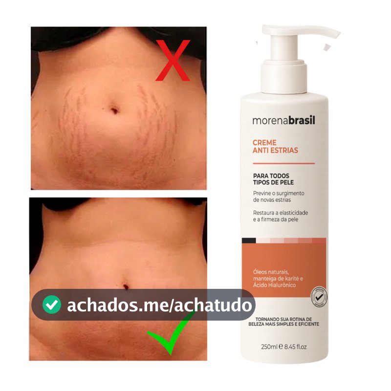 Creme Anti-Estrias - Diga Adeus às Estrias! Previne Novas Estrias & Reforça a Elasticidade Da Pele