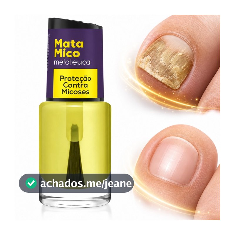 Óleo Anti micose Unhas Melaleuca Proteção Antifúngica Saúde Unhas Hidratação Barreira Protetora esmalte base