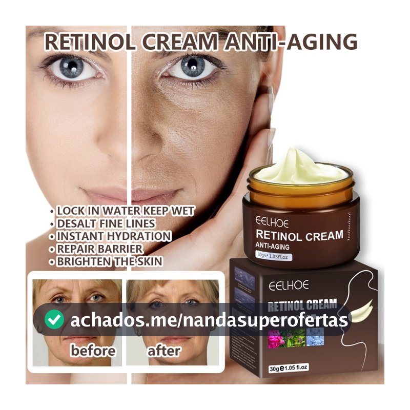 Creme Facial Retinol Anti-Idade Antirrugas Hidratante Reafirmante Clareamento Manchas Reduz Linhas Finas 30g