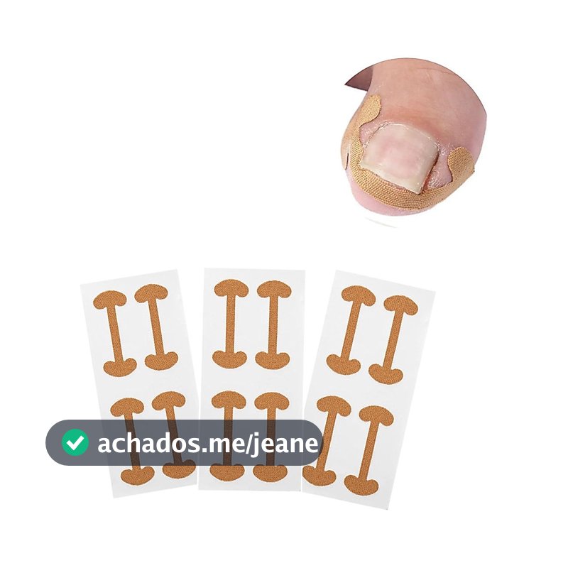 Adesivo Desencrava Unha Encravada 12 Unid Órtese Corretora