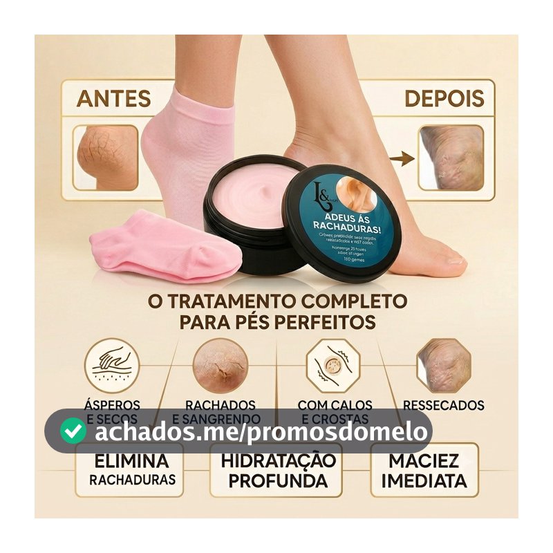 Creme Para Pés + Meias Silicone Hidratação Rachaduras Hidratante Anti Fissuras