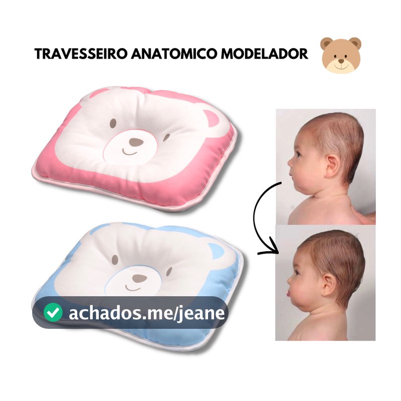 Travesseiro Recem Nascido Modelador Anatomico Ortopedico