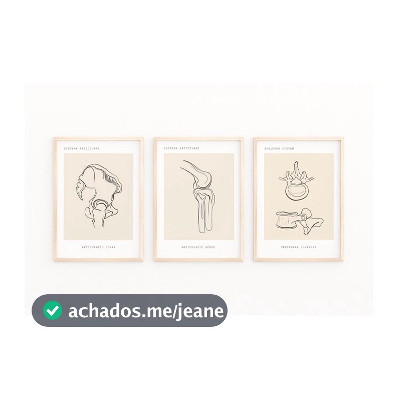 Quadro Decorativo Anatomia Humana, decoração casa Quadro Decorativo Medicina ossos coluna