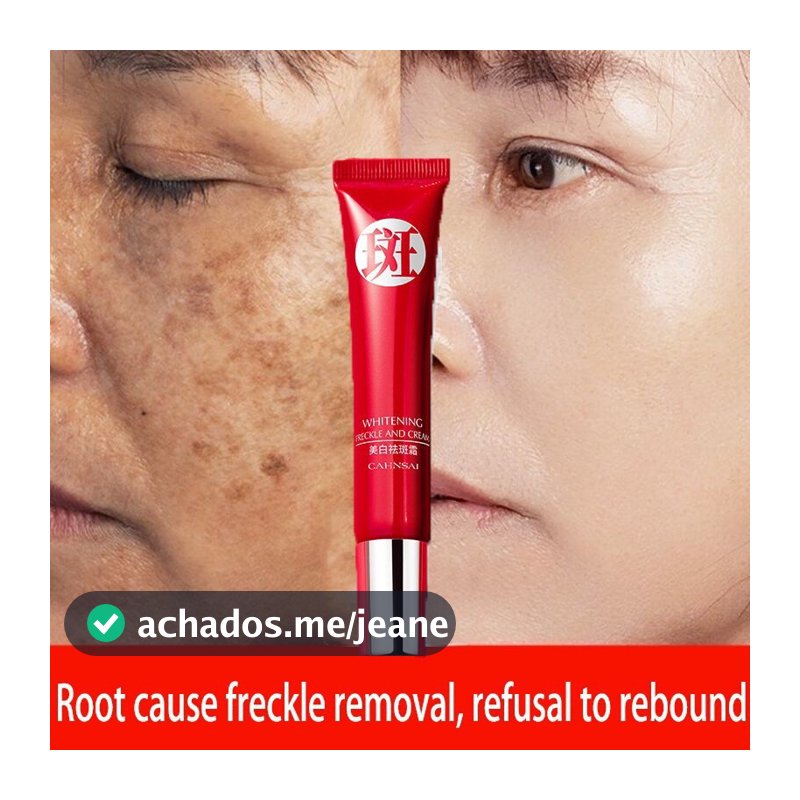 Creme forte original para remover manchas escuras/clareamento de pigmentos/cuidados com a pele QRJZ 2RWB