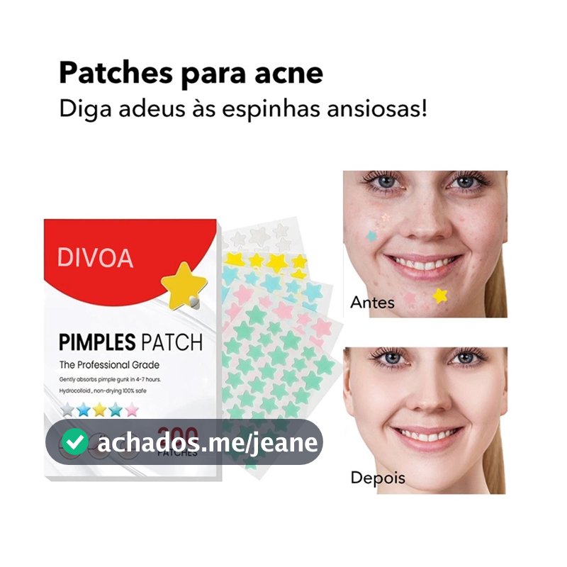 200pcs Acne Patch Adesivo Para Espinha Pimple Patch Estrela Desbotar Hidrocoloide Acne Master Patch Adesivo Para Acne