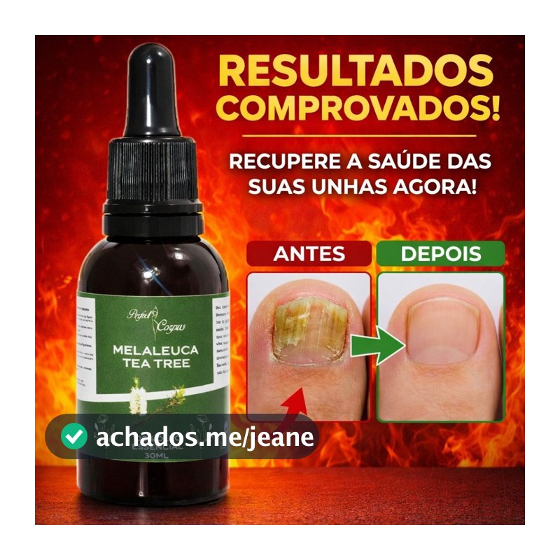 Óleo Essencial de Melaleuca Conta gotas 100% puro 30ML