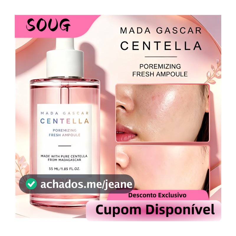【Oferta Limitada】Madagascar Centella Asiatica Ampoule | 55ml | Soothing & Repairing Concentrate | For Sensitive & Irrit
