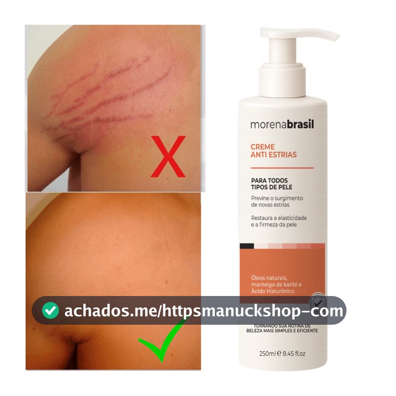 Creme Anti-Estrias Morena Brasil -  Ação Poderosa com Colágeno e Elastina