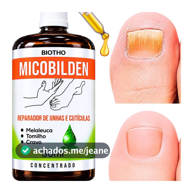 Micobilden para Unhas Fracas e Amareladas Fortalecedor E Regenerador 100% Natural I USO DIÁRIO