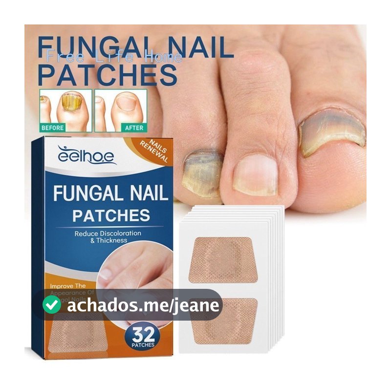 32 Adesivos Antifúngicos Para Tratamento De Unhas , Reparos De Onicomicose , De Venda Quente
