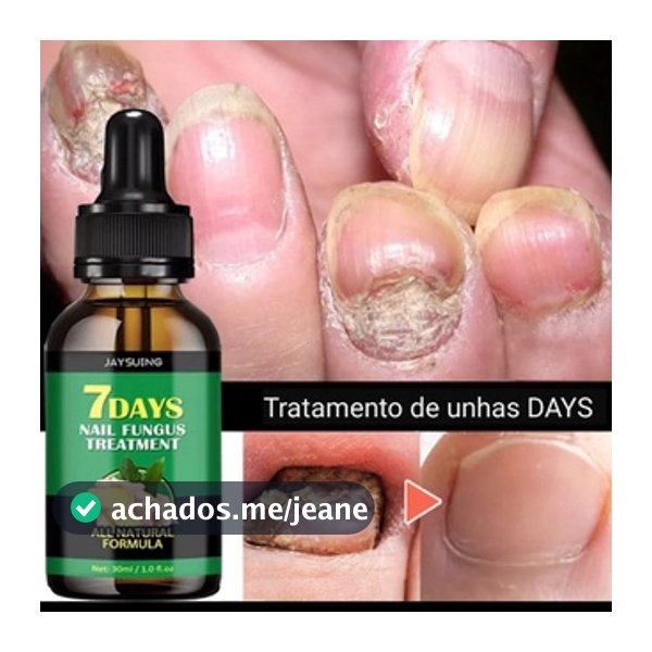 1 FRASCO CUIDADOS COM A UNHA - ENVIO IMEDIATO 10ML