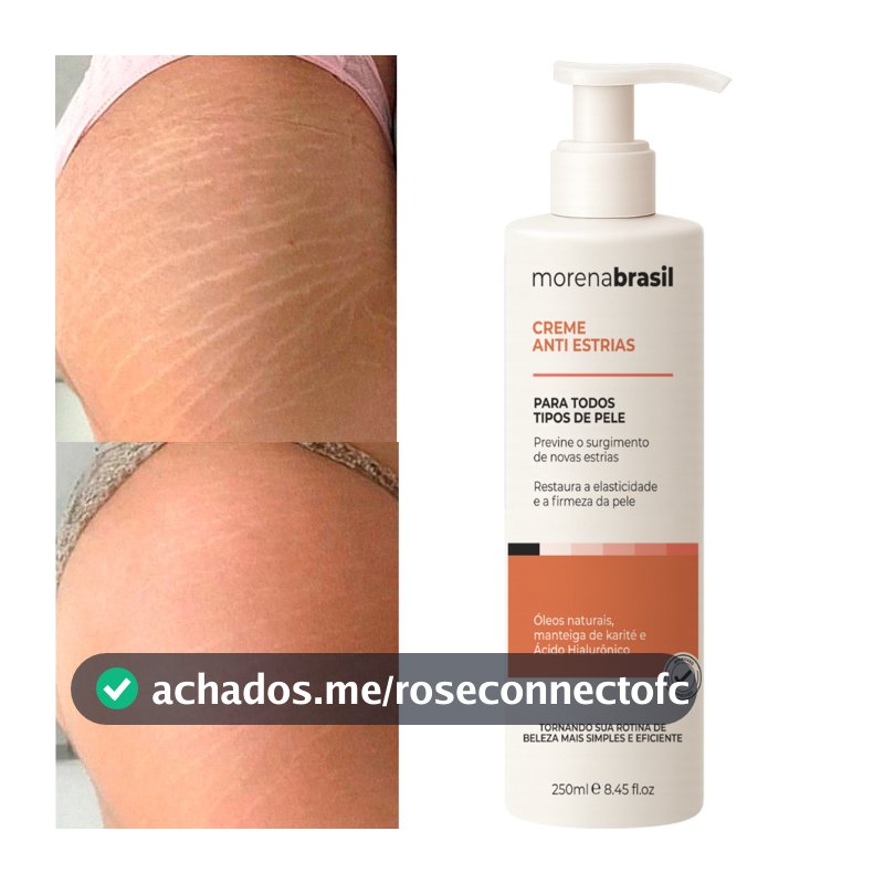 Creme AntiEstrias Removedor Estrias 200g Morena Brasil – Ação Poderosa com Colágeno e Elastina