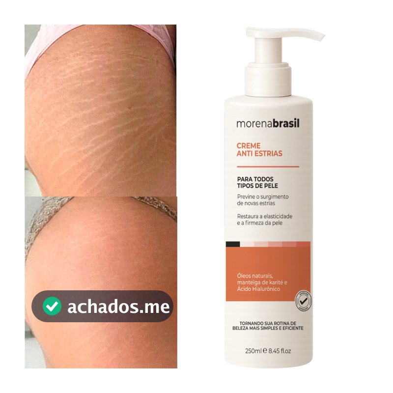 Creme AntiEstrias Removedor Estrias 200g Morena Brasil – Ação Poderosa com Colágeno e Elastina