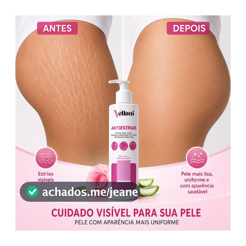 Creme Anti-Estrias Vellani 250ml Estrias Antigas e Novas – Firmeza e Elasticidade da Pele