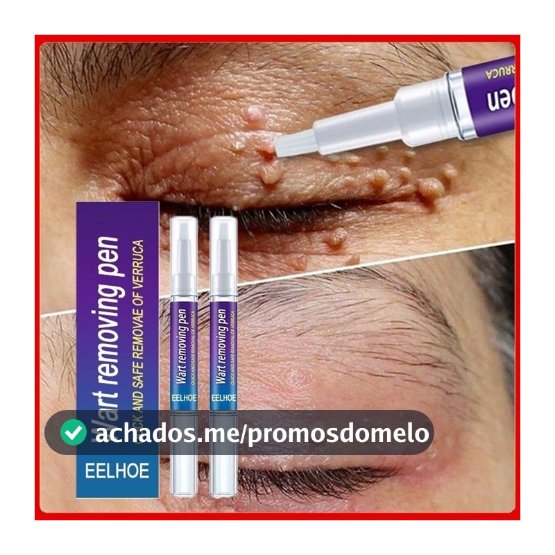 Creme Para Remoção De Partículas De Queratina , Reparo Profundo Da Pele