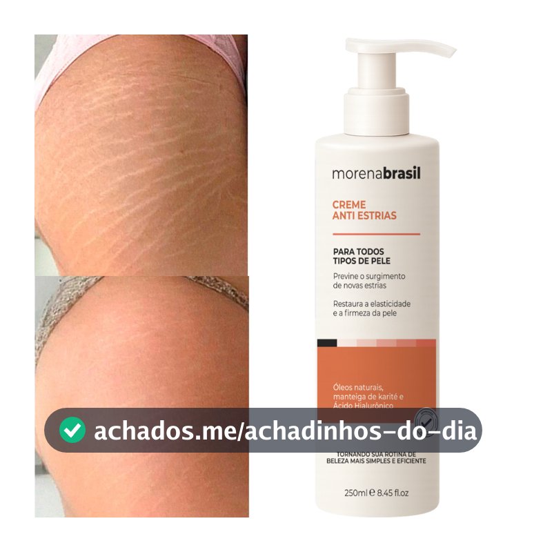 Creme AntiEstrias Removedor Estrias 200g Morena Brasil – Ação Poderosa com Colágeno e Elastina
