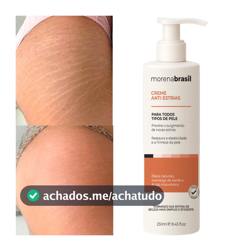 Creme AntiEstrias Removedor Estrias 200g Morena Brasil – Ação Poderosa com Colágeno e Elastina