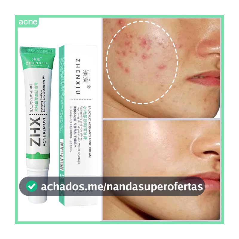 Ácido Salicílico Acne Creme Remover Cravo Controle De Óleo Anti-Tratamento Reparação Espinha Cicatriz Clareamento Facial
