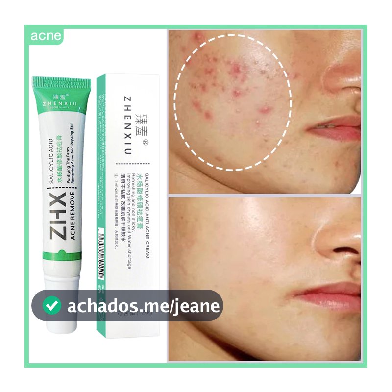 Ácido Salicílico Acne Creme Remover Cravo Controle De Óleo Anti-Tratamento Reparação Espinha Cicatriz Clareamento Facial