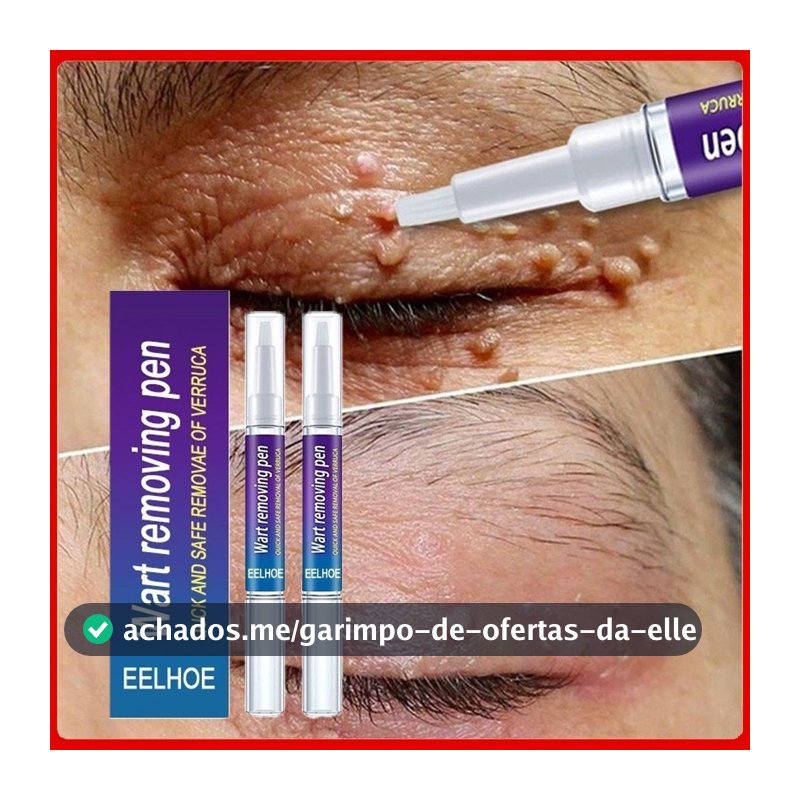 Creme Para Remoção De Partículas De Queratina , Reparo Profundo Da Pele