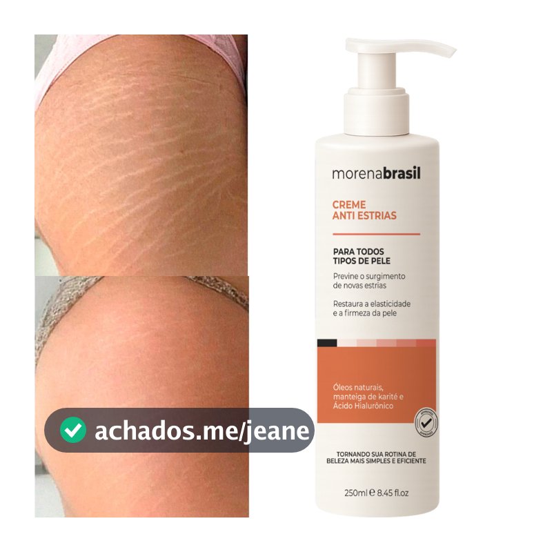 Creme AntiEstrias Removedor Estrias 200g Morena Brasil – Ação Poderosa com Colágeno e Elastina