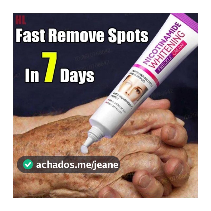 Creme De Melasma Clareador De Niacinamida Suave , Melanina , Remove Pigmento Escuro , Hidratante , Cuidados Com A Pele