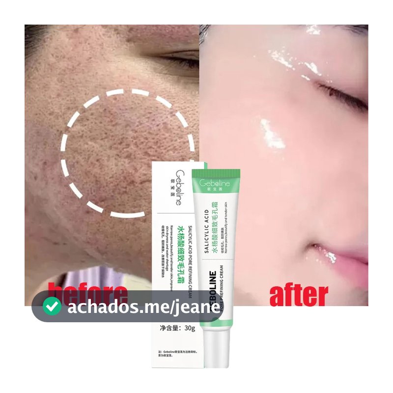 Creme De Ácido Salicílico Para Encolhimento De Poros Apertar O Rosto Produto De Cuidados Com A Pele Lisa Coreana