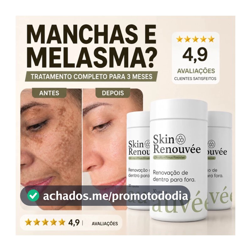 Kit Clareador de Manchas e Melasma Oral - Oli Olá + Pinus Pinaster | 2x 3x ou 5x | Auvée