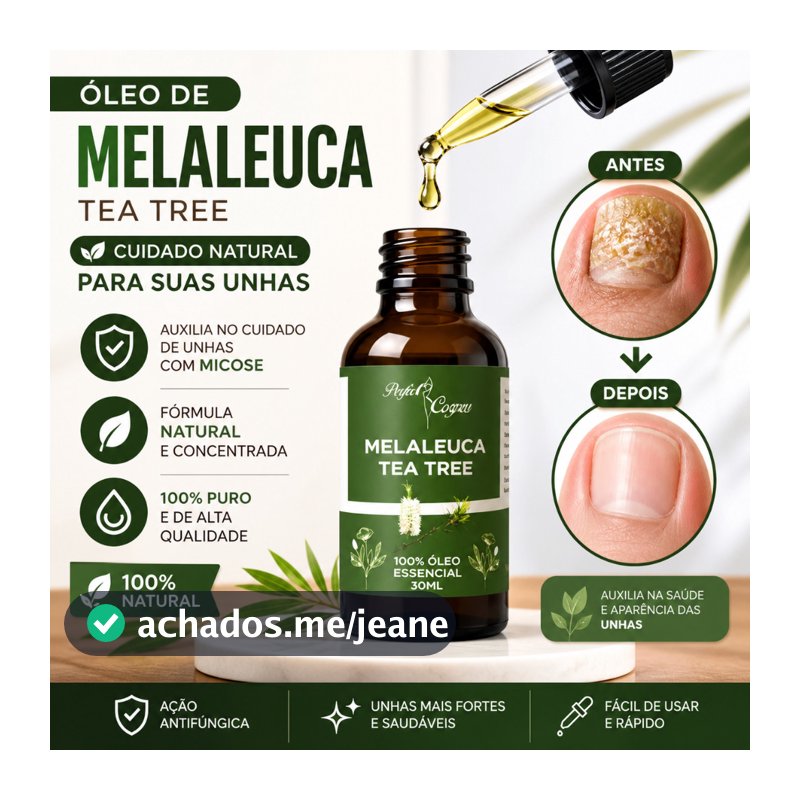 Óleo Essencial De Melaleuca 100% Puro 30ml Contra Micose