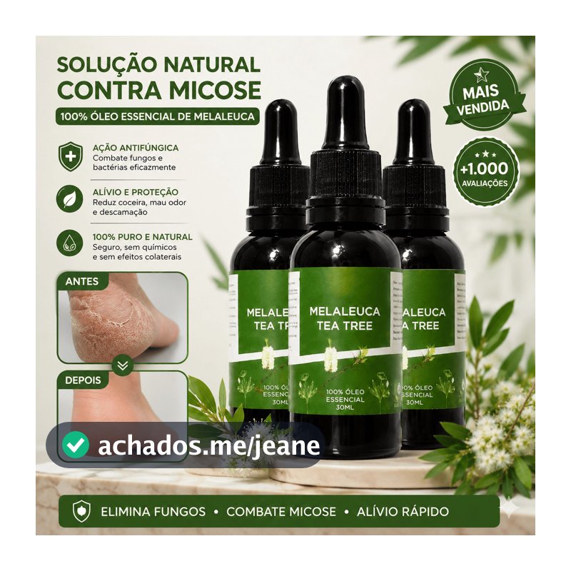 Óleo De Melaleuca Tea Tree 30ml 100% Puro Para Acne Micose Fungos Unhas Pele Couro Cabeludo