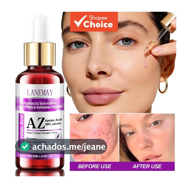 Sérum de Ácido Azelaico 10% - Reduz Rosácea, Hipercromia e Cicatrizes de Acne, com Ácido Hialurônico e Vitaminas B3+B5,