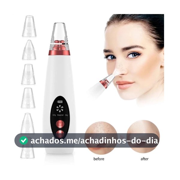 Removedor de Cravos Elétrico Portátil Limpeza Facial a Vácuo Com Ponteiras