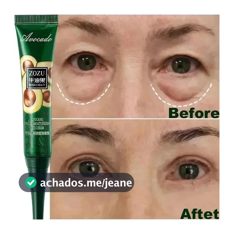 Creme Instantâneo Antirrugas Para Os Olhos , anti-Olheiras , Bolsas E Produtos Inchados Cuidados Com A Pele .