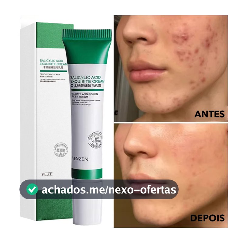 Creme De Ácido Salicílico Para Redução De Poros , Hidratação E Nutrição Da Pele-Hidratante Refinador Loção Facial , Cuid