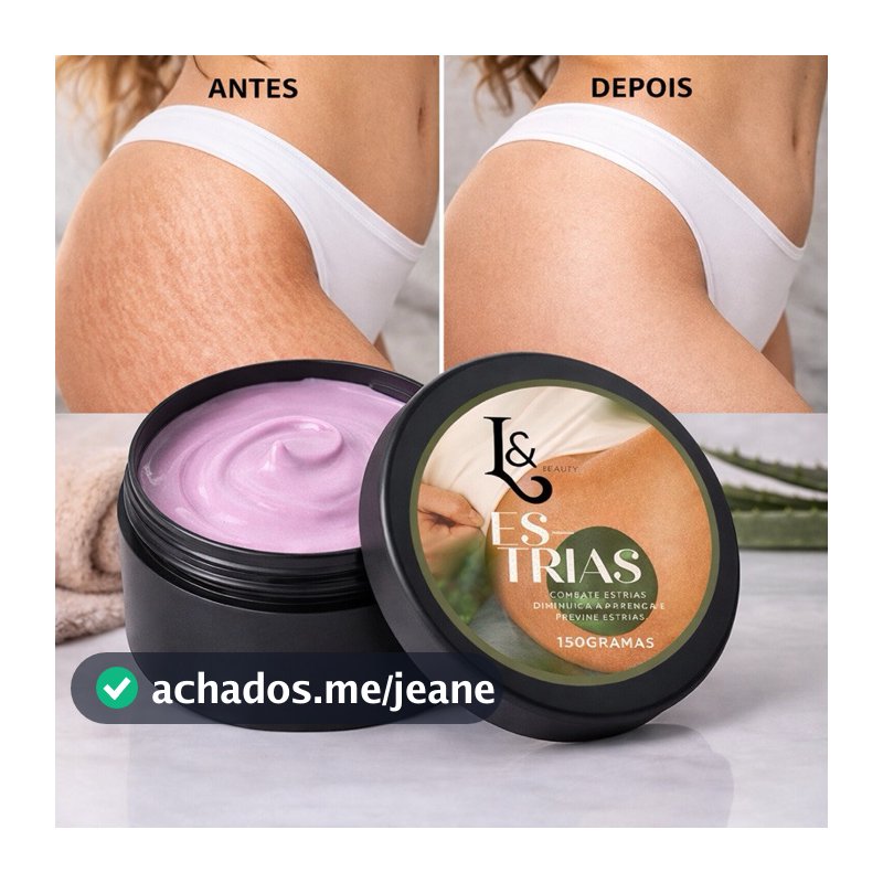 Creme Para Estrias 150g Redutor Clareador Anti Estrias Brancas Vermelhas Hidratante Corporal L&Beauty
