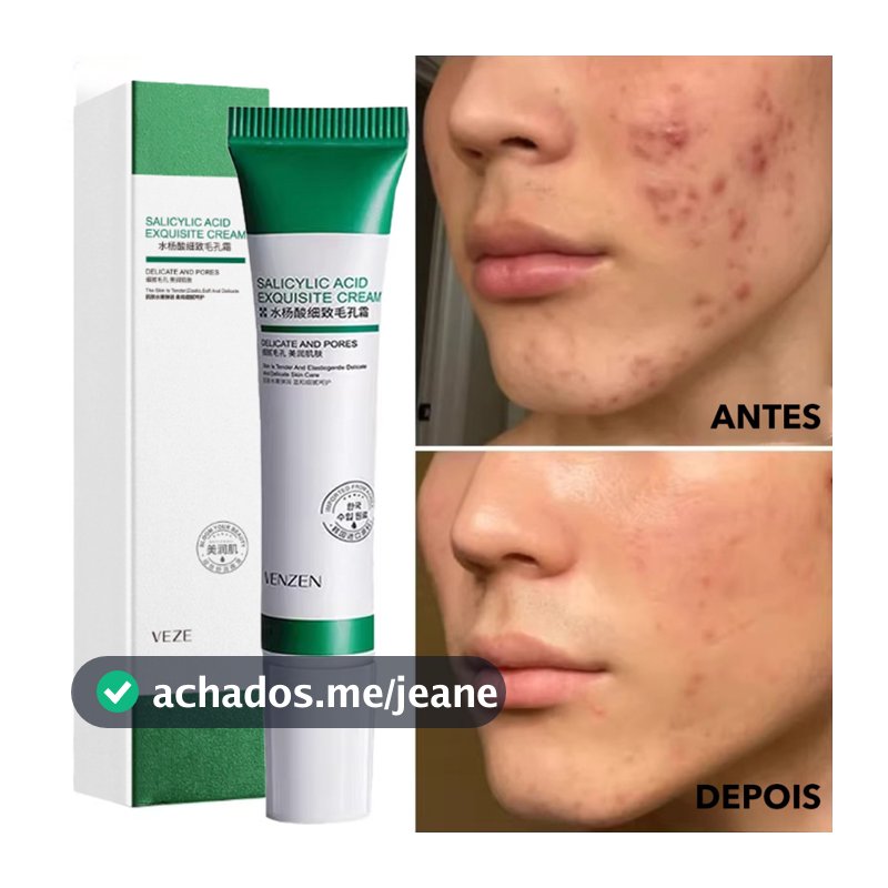 Creme De Ácido Salicílico Para Redução De Poros , Hidratação E Nutrição Da Pele-Hidratante Refinador Loção Facial , Cuid