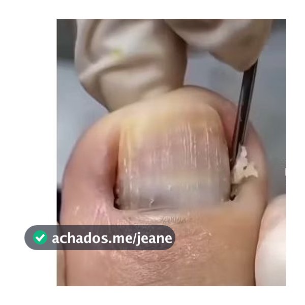 02 Goivas Desencravadoras Afiadas Inox Esterizaveis Profissionais 14Cm P/Manicure Pedicure Podólogos Ref 206 Globalmil.