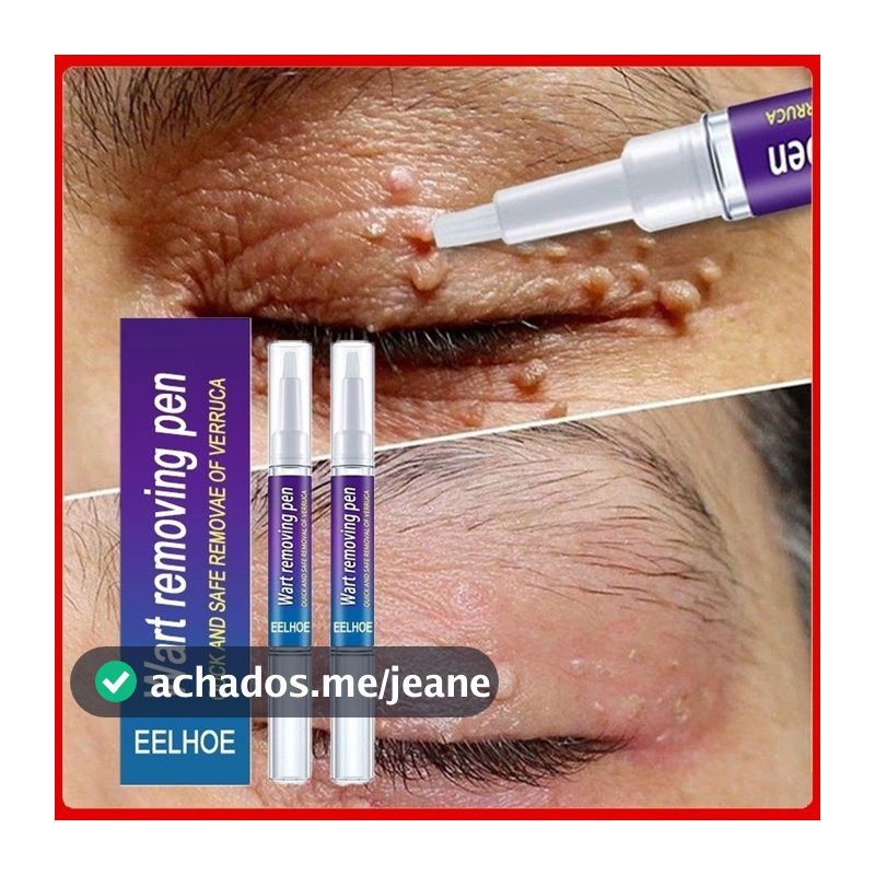 Creme Para Remoção De Partículas De Queratina , Reparo Profundo Da Pele