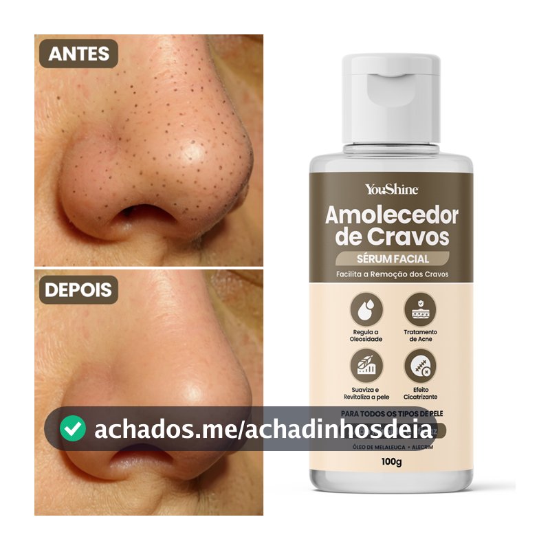 Sérum Amolecedor de Cravos YouShine 100g Facial Auxilia Remoção