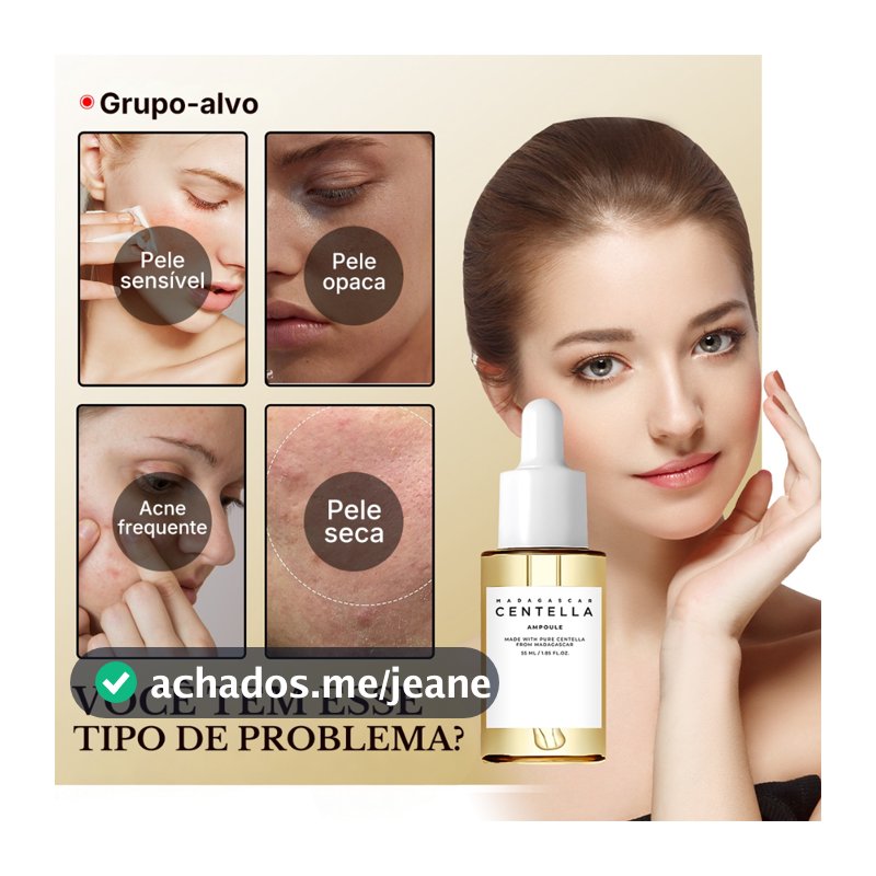 Centella Asiatica Essência Facial Iluminadora Hidratante Suavizante Essência Facial |Acaba com Vermelhidão | Inverno