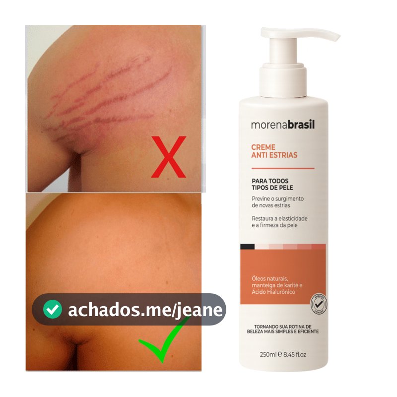 Creme Anti-Estrias Morena Brasil - Ação Poderosa com Colágeno e Elastina