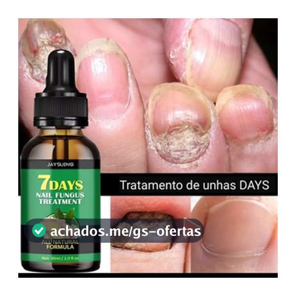 1 FRASCO CUIDADOS COM A UNHA - ENVIO IMEDIATO 10ML